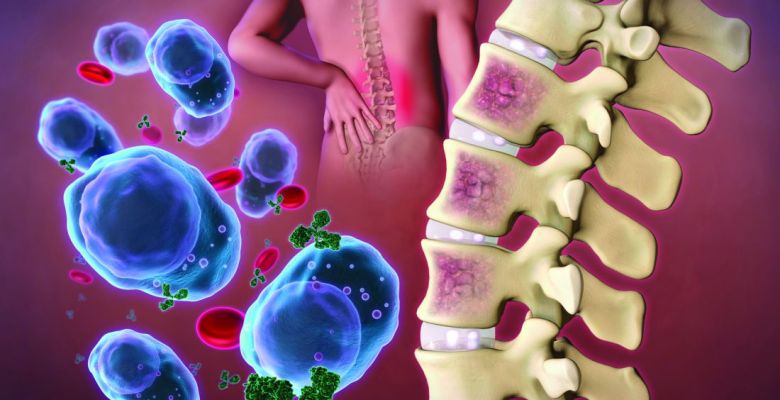 Lynozyfic: A New Hope in Blood Cancer Treatment